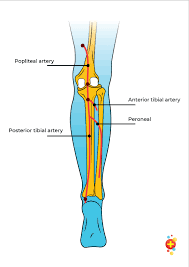 Your healthcare provider can help explain the details of your for a fracture in the middle part of the tibia, healthcare providers often use a specially designed long metal rod that passes through the middle of the bone. Fibula Fractures