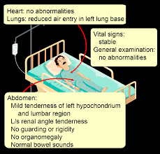 Image result for Perinephric Abscess