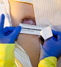 Image result for Comprehensive Skin Integrity Assessment