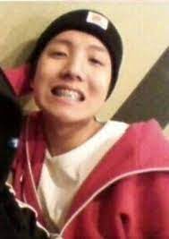 Hobi Used To Have Braces D Bts Predebut Hoseok Bts Boys