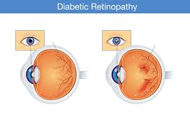 I spis dig slank efter dit blodsukker giver overlæge og professor arne astrup og ernæringsekspert christian bitz dig en køreplan for, hvad du skal spise, hvis. 8 Advarsler Pa At Du Har Hoyt Blodsukker Og Trenger Hjelp