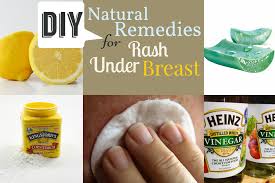 Pin On Rashes