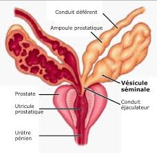 Voies spermatiques extra testiculaires et prostate