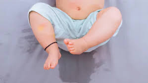 Image result for Enuresis