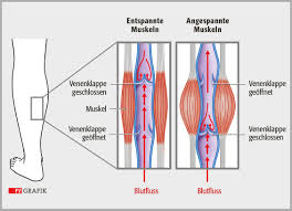 Krampfadern betreffen vor allem die hautnahen venen am bein und ihre verbindungen nach innen. Krampfadern Und Cellulite Beine In Bestform Pz Pharmazeutische Zeitung
