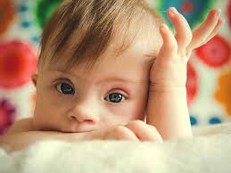 About down syndrome down syndrome (ds), also called trisomy 21, is a condition in which a person is born with an extra chromosome. Down Syndrome Causes Types And Symptoms
