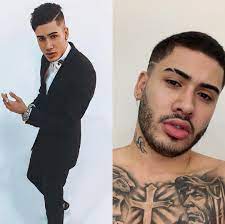 O famoso antes e depois. Kevinho Mostra Antes E Depois E Brinca Nao Mudei So A Barba Jetss