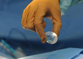 Many men do not tell their health care with testicular cancer, cells are looked at after surgery is done to remove the cancerous tissue. Dr David B Samadi Health Blog 10 Testicular Cancer Symptoms Not To Be Ignored Blog Dr David B Samadi El Pais