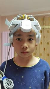 Millie's brain therapy treatment and recovery at NeuroSolution Center