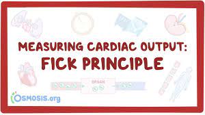 The cardiac output calculator employs the fick principle to estimate the amount of blood (in ml/min) that the heart muscle pumps in the systemic circulation from the left ventricle. Measuring Cardiac Output Fick Principle Osmosis