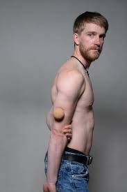 Include (or exclude) self posts. Shoulder Blade Pain Relieve It Yourself