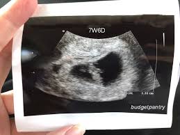 Normally during a pregnancy ultrasound, a baby is measured by crl (crown rump length). Pregnancy 2 A Flickering Heartbeat At My 6w5d Ultrasound Scan Budgetpantry Singapore Mummy Blog On Food Recipe Baby