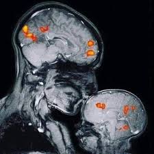 الصورة التي احتلت مواقع التواصل Brain Mother And Child Mothers Love