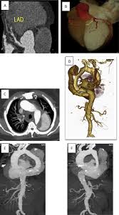Features fast and concise medical definitions and information on medical medical dictionary is a free resource to look up medical terms. Value Of Triple Rule Out Ct In The Emergency Department Sciencedirect