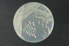 Image result for Rhizobium radiobacter, syn. Agrobacterium tumefaciens