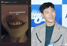 Fakat hyeri'nin tek destekçisi ryu jun yeol değil. Netizen Buzz Han Seohee In Trouble For Copying Ryu Jun Yeol S Smile