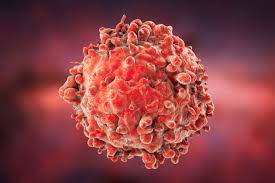 Liver cancer on the rise. An Ongoing Revolution In Blood Cancer Scientific American