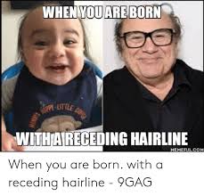 Funny, receding, hairline, looks, upvote, head. 25 Best Memes About Funny Hairline Funny Hairline Memes
