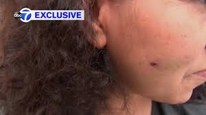 What makes each gun different and how these differences can affect performance and usage. Hispanic Woman Shot With Bb Gun In Face In Middle Village Queens In Possible Bias Crime Abc7 New York