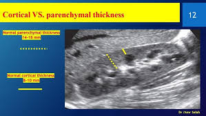 Pin By Nasi Bulbul On Radiology In 2020 Diagnostic Medical Sonography Ultrasound Sonography Ultrasound