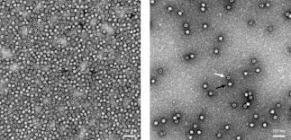 Image result for Silver Grey 1995 AAV