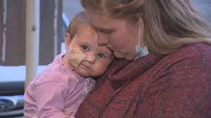 Her Cheek Was Hanging Off 1 Year Old B C Girl Has Long Recovery After Dog Attack Globalnews Ca