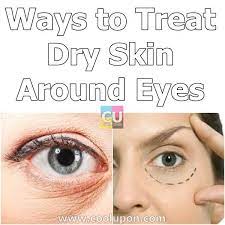 10 Ways To Treat Dry Skin Around Eyes Coolupon Dry Skin Around Eyes Dry Skin Under Eyes Healing Dry Skin