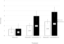 Keep the treated area moist at all times for 1 week, to avoid scab formation. Microneedling In Androgenetic Alopecia Comparing Two Different Depths Of Microneedles Faghihi 2021 Journal Of Cosmetic Dermatology Wiley Online Library