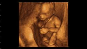 Schönes bild mit trauerspruch baby. 16 Schwangerschaftswoche 16 Ssw Alle Infos Eltern De