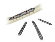 VariAx 2 Compression Plating System | Stryker