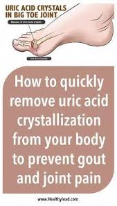 Pin On Arthritis Info