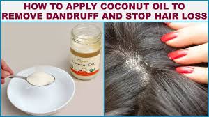 How To Apply Coconut Oil To Remove Dandruff And Stop Hair Loss Apply Coconut Oil Oils For Dandruff Coconut Oil For Dandruff