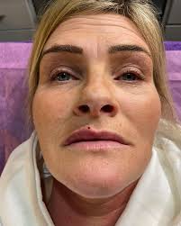 𝐀𝐄𝐒𝐓𝐇𝐄𝐓𝐈𝐂𝐒 𝐀𝐍𝐃 𝐁𝐄𝐀𝐔𝐓𝐘 𝐁𝐘 𝐂𝐀𝐒𝐒𝐈𝐄  (@cassie_aesthetics_) • Instagram photos and videos