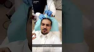 د فهد السديري تجربتي مع الخلايا الجذعية لتساقط الشعر youtube