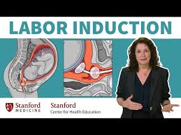 Image result for Labor Induction