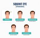 Squint Eye - Meaning, Causes, Treatment & Surgery