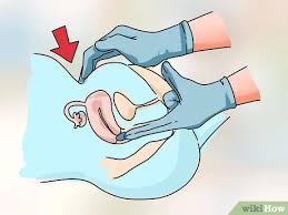 Pada kehamilan yang normal, biasanya juga terjadi flek. Cara Mengenali Tanda Tanda Keguguran Kandungan 13 Langkah