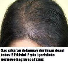 Kellige Son Sac Cikaran Dogal Kur Bayanlar Kahvesi Com Hair Cure Hair Loss Remedies Hair Loss Treatment