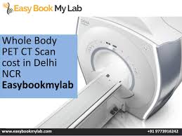 Prices are dependent on the body part and whether contrast is required. Whole Body Pet Ct Scan In Delhi Ncr By Easybookmylab Issuu