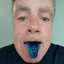 Methylene blue for ich treatment in aquariums?