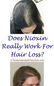 Female pattern hair loss (fphl) is a common cause, and it increases with advancing age. Reasons For Hair Loss In Young Females Can Metoprolol Tartrate Cause Hair Loss Anti Hair Loss Vitamins Dht Supplemen Hair Loss Hair Loss Women Body Hair Loss