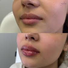 Love learning from the BEST! Thank you Allergan, you did it again! Chic  restaurant, awesome food and drinks, and of course, the wisdom of Dr. Deb  Sherman. It all is making sense!