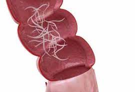 Biji pepaya mengandung carpaine, sitosterol, dan caricin yang terbukti efektif untuk membunuh cacing. Awas Cacing Kremi Bisa Menyerang Vagina