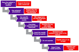 Image result for Intraosseous Access