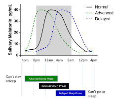 Image result for Delayed Sleep Phase