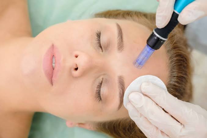 Skin rejuvenation results at Profrea