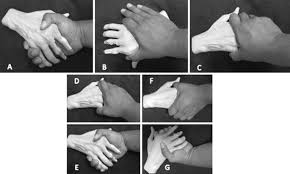 Image result for Squeeze Test