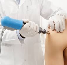 Shockwave Therapy - Valiant Clinic