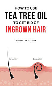 But why do ingrown hairs become such an issue? Pin On Hair