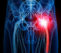 | 9 tips for sleeping with sciatica. Ask Dr Rob About Piriformis Syndrome Harvard Health